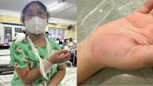 Vụ học sinh lớp 4 bị cô giáo đánh vào tay: Thông tin từ bệnh viện, giáo viên bất ngờ trước kết quả khám