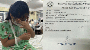 Vụ cô giáo đánh học sinh phải bó bột ở Huế: Diễn biến mới quá trình xử lý vụ việc? Tình hình em nhỏ?