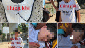 Gia đình xót xa khi con học lớp 6 bị bạn đánh phải cấp cứu: Nguyên nhân xô xát? Tình trạng hiện tại?