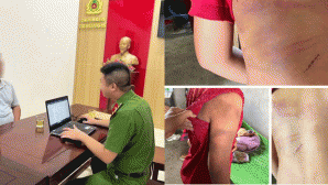 Diễn biến nóng vụ mẹ đau đớn công khai tình trạng ‘đầy ám ảnh’ của con trai nghi bị bố ruột bạo hành