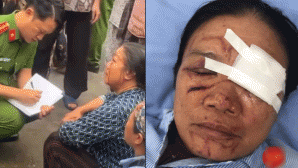 Trách nhiệm pháp lý vụ người phụ nữ bán rau bị xịt nước áp lực cao dẫn đến chảy máu mắt gây bức xúc
