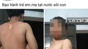 Thông tin mới vụ bé trai nghi bị mẹ ruột tạt nước sôi vào người ở Đắk Lắk