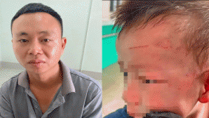 Bắt tạm giam cha dượng bạo hành con riêng của vợ, phẫn nộ lý do gã đàn ông đánh cháu bé nhập viện