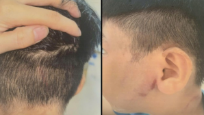 Bé trai 8 tuổi bị cha ruột đánh đến nhập viện: Bà ngoại kể lại cảnh tượng sau cuộc gọi cầu cứu