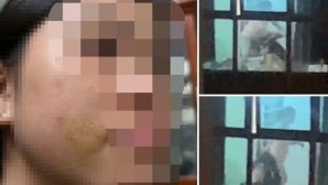 Mẹ kế ở Phú Thọ thừa nhận đánh con riêng của chồng, nạn nhân từng chảy máu đầu nhưng không dám kể