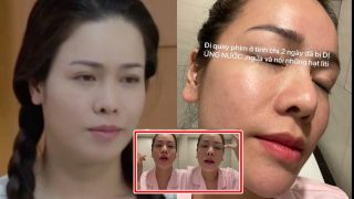 Nhật Kim Anh đăng ảnh nổi mẩn chi chít, mặt mộc tuổi 35 sau khi trút bỏ son phấn gây ngỡ ngàng