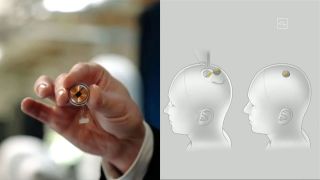 HOT: Công ty của tỷ phú Elon Musk chuẩn bị thử nghiệm chip cấy ghép trong não con người