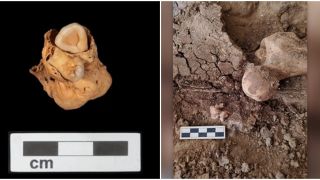Phát hiện khối u có răng hiếm gặp trong lăng mộ Ai Cập từ 3.000 năm trước