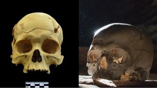 Hộp sọ 2.700 năm tuổi hé lộ điều gây sốc về y học thời cổ đại, thế giới chấn động không dám tin