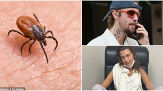 Justin Bieber, Bella Hadid và loạt ngôi sao đình đám mắc bệnh Lyme khó chữa do ve truyền