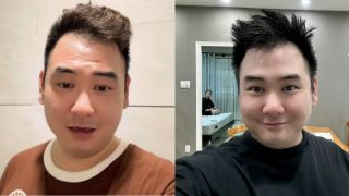 Xemesis sụt 20kg sau khi chia tay Xoài Non, cân nặng và ngoại hình hiện tại gây lo lắng