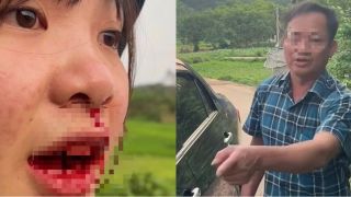 Rộ tin người chặn xe, đánh cô gái 23 tuổi ở Bắc Giang là cán bộ xã, lãnh đạo địa phương nói gì?