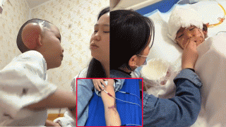 Cậu bé 7 tuổi bị 3 con chó cắn: Viền tai bị đứt hoàn toàn, đứt cơ nách và đứt rời bắp chân trái