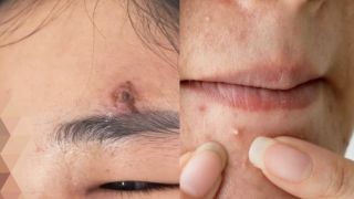 Cô gái ở Hà Nội suýt chết vì tự ý thói quen tưởng chừng vô hại, bác sĩ cảnh báo hậu quả khôn lường 
