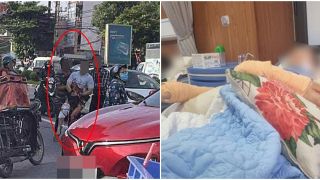 Tiktoker Hà List kinh hoàng kể khoảnh khắc bị 4 giang hồ bịt kín mặt chém lìa tay, tiết lộ nguồn cơn sự việc
