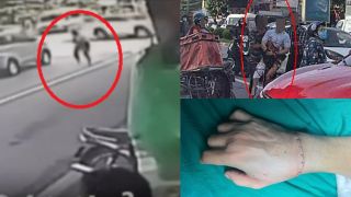 Camera ghi lại cảnh Tiktoker Hà List bị chém lìa tay: 30 giây ‘ra tay’ đầy lạnh lùng giữa phố 