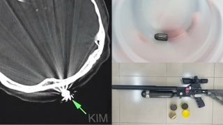 Lời khai của người bắn súng khiến người phụ nữ làm vườn trúng đạn, hé lộ mục đích vác súng ra đường