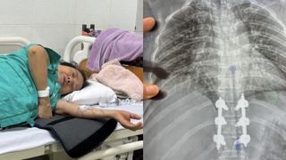 Tìm tài xế xe máy đâm bà lão ở Buôn Ma Thuột rồi bỏ trốn: Nạn nhân gãy 3 đốt sống, chưa có tiền phẫu thuật