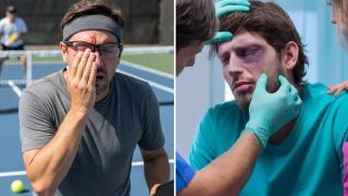 Chấn thương mắt khi chơi pickleball tăng mạnh, chuyên gia cảnh báo cảnh báo nguy cơ tiềm ẩn