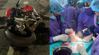 Hành trình nối chân cho nữ sinh 19 tuổi sau tai nạn với mô tô phân khối lớn: Tiết lộ ‘thời gian vàng’ để nối chi thể