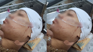 Lời khai của nữ cán bộ phường cầm dao rạch mặt tình địch vì ghen tuông ở Đồng Tháp, gia đình có động thái lạ