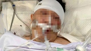 TPHCM: Tông trúng chó chạy rông, nam thanh niên nhập viện trong tình trạng 'ngàn cân treo sợi tóc'