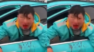 Hà Nội: Tài xế xe ôm công nghệ bị đồng nghiệp tấn công chảy máu mồm, mâu thuẫn do đâu?