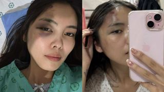 Người vợ bị chồng đánh chấn động não hé lộ tình tiết phẫn nộ, vợ cũ ra mặt vạch trần bản chất người đàn ông