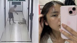 Diễn biến mới vụ chồng đánh vợ thủng màng nhĩ, chấn động não ngay trước mắt hàng xóm ở Hà Nội