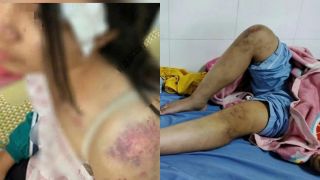 Sau vụ bé gái 12 tuổi ở Thái Nguyên bị bạo hành: Cư dân mạng bức xúc ‘bóc phốt’
