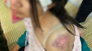 Đã có kết quả giám định thương tật vụ bé gái bị bà nội và 2 người đàn ông hành hạ gây bức xúc