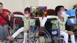 Bé trai 5 tuổi bị bỏng 65% trong vụ phóng hỏa Gia Lai hồi sinh ngoạn mục