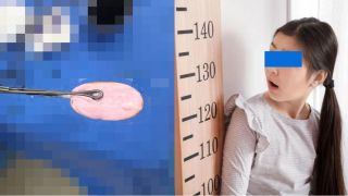 TP.HCM: Bé gái 12 tuổi cấp cứu vì nhét cục xà bông vào ‘nơi riêng tư’, bác sĩ cảnh báo khẩn