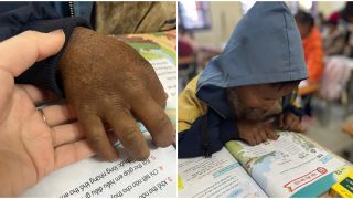 Câu chuyện xúc động đằng sau bức ảnh bàn tay sạm đen, nứt nẻ của em bé 8 tuổi ở vùng cao