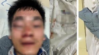 Vợ tài xế xe buýt bị đánh đến chấn thương sọ não ở Hà Nội tiết lộ thông tin quan trọng về hung thủ