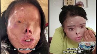 Bị chồng cũ tạt axit mù mắt: Người phụ nữ gây sốc khi tự ‘vẽ’ lại dung nhan để đổi đời