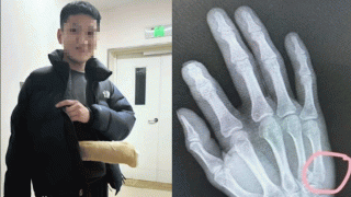 Ông bố nhập viện sau khi kèm con học, lời chia sẻ sau chấn thương 'đánh trúng tim đen' nhiều phụ huynh