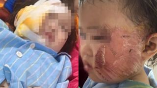 Không thỏa thuận phí bồi thường vụ đổ trần thạch cao, gia đình cháu bé 22 tháng tuổi kiện nhà trường