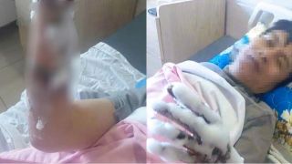 Thanh Hóa: Nam công nhân bỏng nặng 2 tay vì bị phóng điện, ngành chức năng công bố nguyên nhân