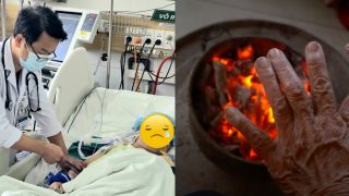 Sưởi ấm giữa đợt rét đậm, thói quen quen thuộc khiến nhiều người nhập viện, có ca không qua khỏi tại Hà Nội