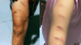 Chủ tịch UBND tỉnh Cà Mau lên tiếng vụ bé gái lớp 5 bị chị họ dùng dao cắt giấy rạch nhiều nhát