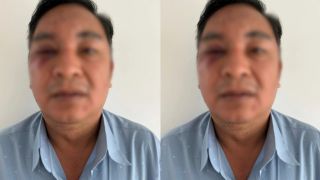 Công an xác định nguồn cơn vụ 2 nam 1 nữ xông vào đánh, nổ súng với một người đàn ông ở Đồng Nai