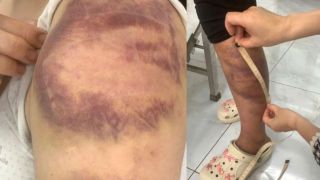 Vụ người đàn ông trói con gái, đánh đập vợ bầu ở Bắc Ninh: Đối tượng bị xử lý những tội gì?