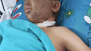 TP.HCM: Nam thanh niên mất một mắt sau khi thực hiện tục lệ quen thuộc ngày Tết, tình hình nạn nhân