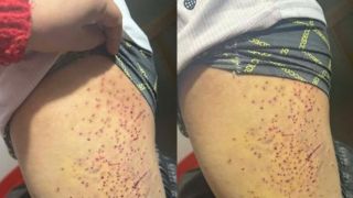 Thông tin học sinh nghi bị bạn dùng vật nhọn gây thương tích ở Lào Cai: Chính quyền lên tiếng