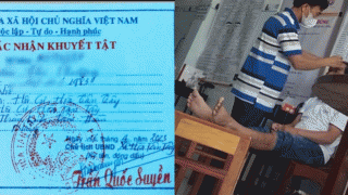 Thông tin vụ phát hiện người phụ nữ bị tâm thần nặng ‘điều trị nhiều bệnh’ cho người dân tại Đắk Lắk