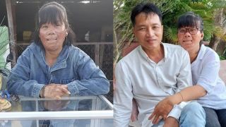 Người phụ nữ bỏng 78% cơ thể vì cứu con riêng của bạn trai nhưng rồi lại bị bỏ rơi, cuộc sống hiện ra sao?