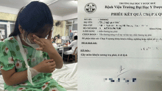 Vụ cô giáo đánh học sinh phải bó bột ở Huế: Diễn biến mới quá trình xử lý vụ việc? Tình hình em nhỏ?