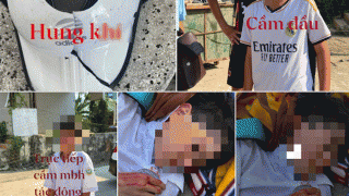 Gia đình xót xa khi con học lớp 6 bị bạn đánh phải cấp cứu: Nguyên nhân xô xát? Tình trạng hiện tại?