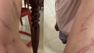 Vụ con gái 9 tuổi nghi bị mẹ ruột tác động vật lý 34 vết bầm: Người bố tiết lộ loạt tình tiết gây bất ngờ